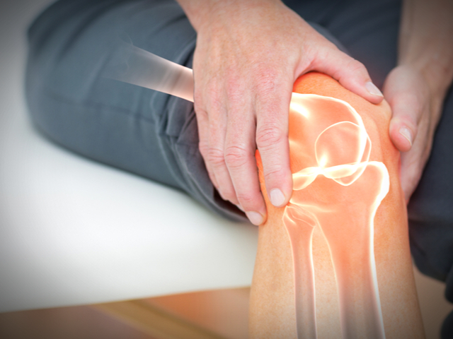 変形性膝関節症への対応